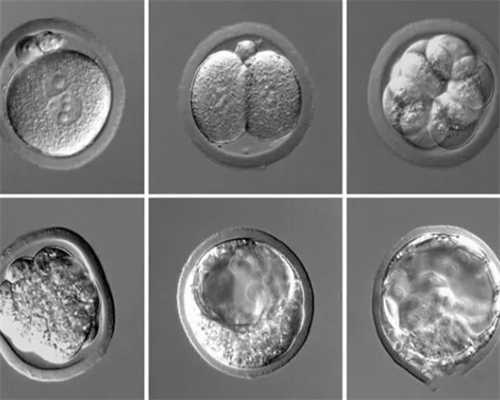 北京减门诊最好的~代生医院